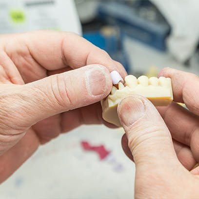 Advanced Laser Dentistry Technology